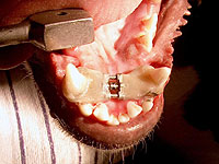 I psi mohou pot�ebovat rovn�tka